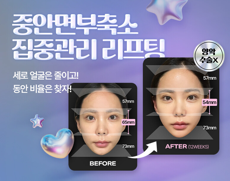 V&MJ피부과,울쎄라, 커스텀울쎄라, 울쎄라시술, 울쎄라전문, 울쎄라리프팅, 울쎄라리프팅시술