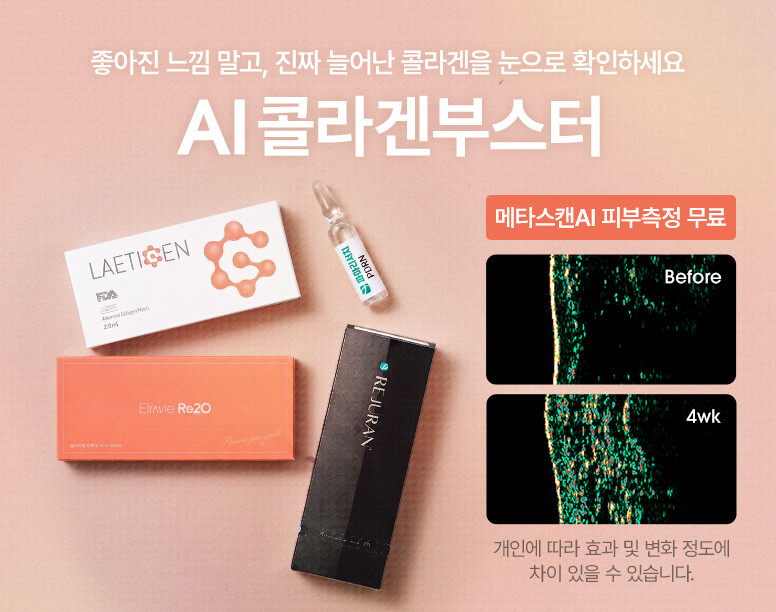 V&MJ피부과,울쎄라, 커스텀울쎄라, 울쎄라시술, 울쎄라전문, 울쎄라리프팅, 울쎄라리프팅시술