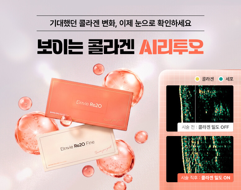 V&MJ피부과,울쎄라, 커스텀울쎄라, 울쎄라시술, 울쎄라전문, 울쎄라리프팅, 울쎄라리프팅시술