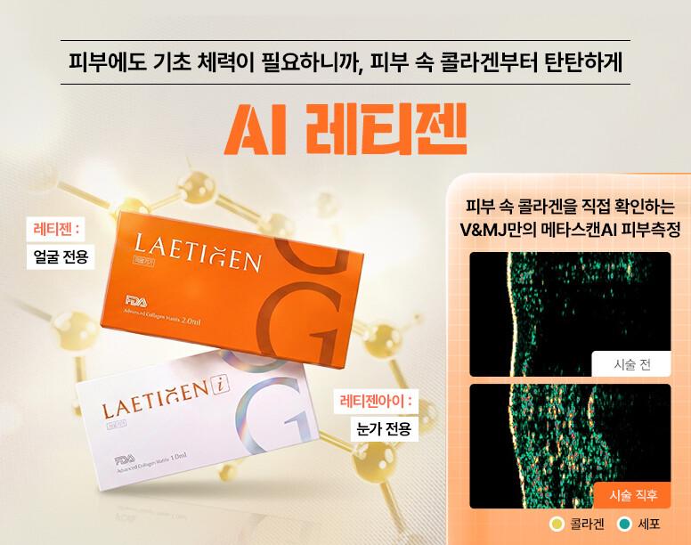 V&MJ피부과,울쎄라, 커스텀울쎄라, 울쎄라시술, 울쎄라전문, 울쎄라리프팅, 울쎄라리프팅시술