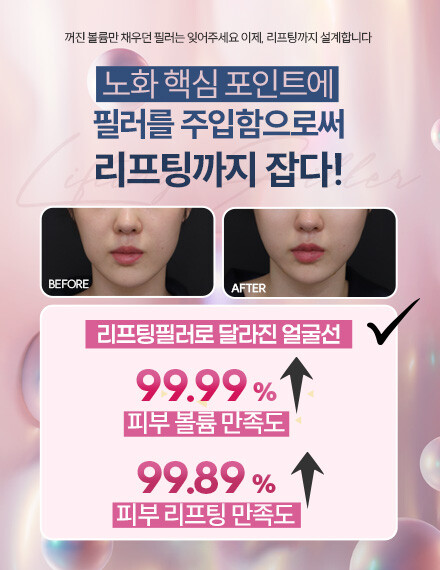 V&MJ피부과,울쎄라, 커스텀울쎄라, 울쎄라시술, 울쎄라전문, 울쎄라리프팅, 울쎄라리프팅시술