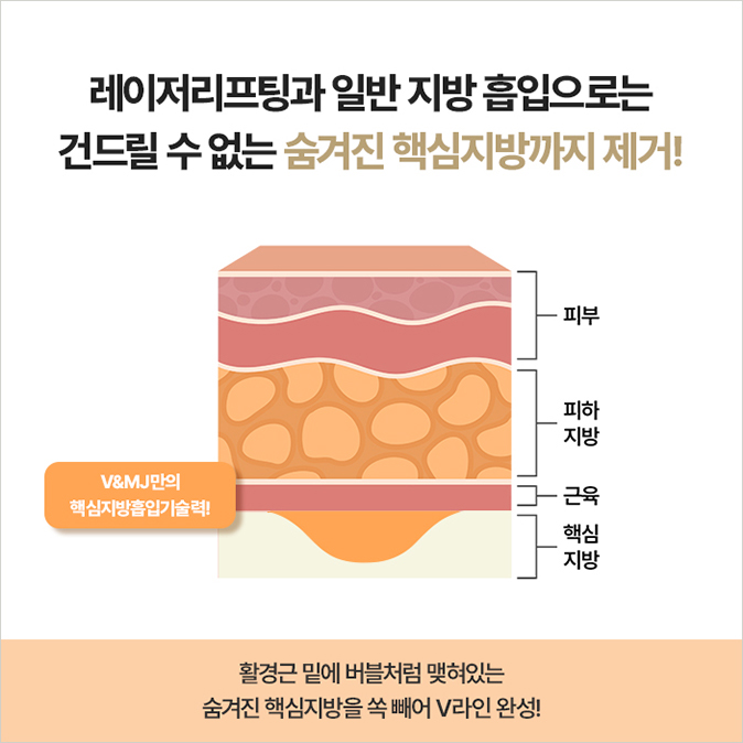 3D엑소좀,볼빛주사,레니스나,엑소좀포텐자,포텐자엑소좀,미라젯스킨부스터,포텐자쥬베룩,홍대쥬베룩,울쎄라토스,아토스레이저,포텐자레이저,강남역쥬베룩,쥬베룩흉터,압구정쥬베룩,이중턱제거,이중턱,지방흡입