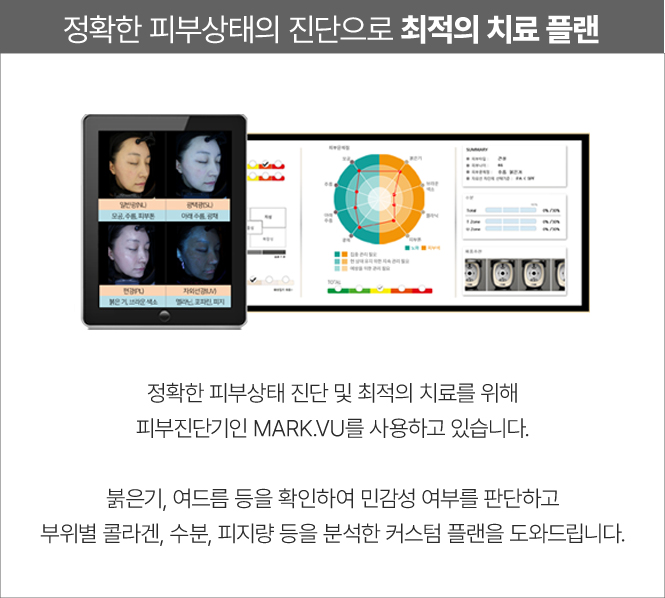스킨부스터,잘루프로,피부재생,피부보습,콜라겐부스터,울트라콜200,울트라콜,리쥬란힐러,마스크팩,리쥬란,피부비타민,리쥬란HB,리쥬란힐러가격,피부좋아지는법