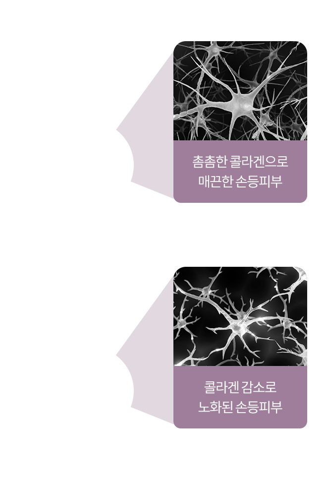 강남울쎄라,울쎄라피부과,울쎄라수면마취,울쎄라잘하는곳,압구정울쎄라,써마지울쎄라,울쎄라300샷,울써마지가격,아이써마지가격,아이써마지