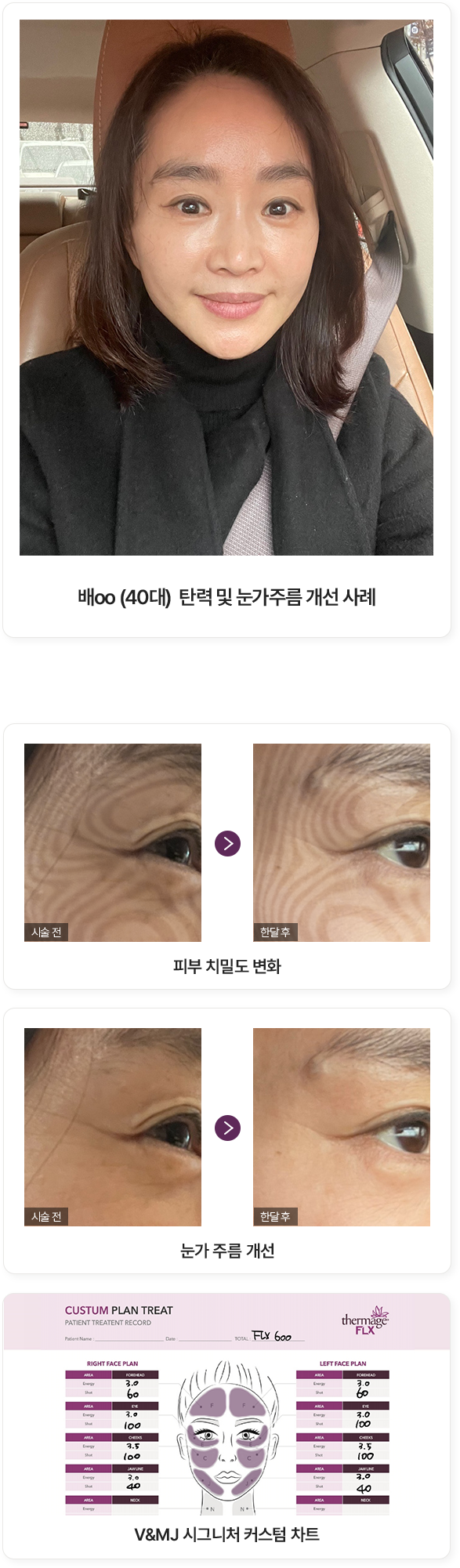울쎄라, 커스텀울쎄라, 울쎄라시술, 울쎄라전문, 울쎄라리프팅, 울쎄라리프팅시술