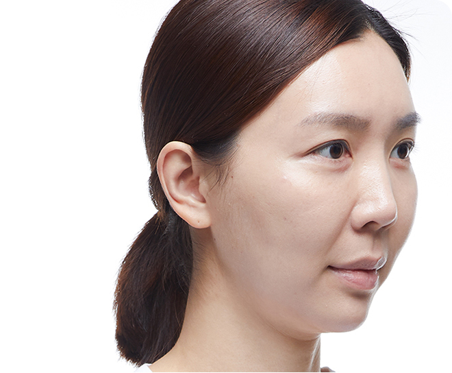 홈에스테틱,홈쎄라,압구정로데오피부과,가정용리프팅,갈바닉마사지기,강남튠페이스,홈케어디바이스,가정용미용기기,리프팅기기,슈링크유니버스