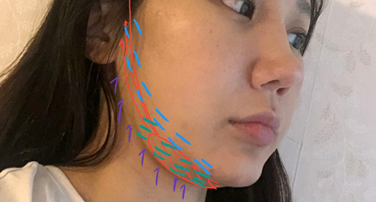 커스텀울쎄라,울쎄라부작용,울쎄라효과,울쎄라가격,울쎄라통증,울쎄라써마지,울쎄라전후,울쎄라인모드,가정용울쎄라,울쎄라슈링크,울쎄라올리지오