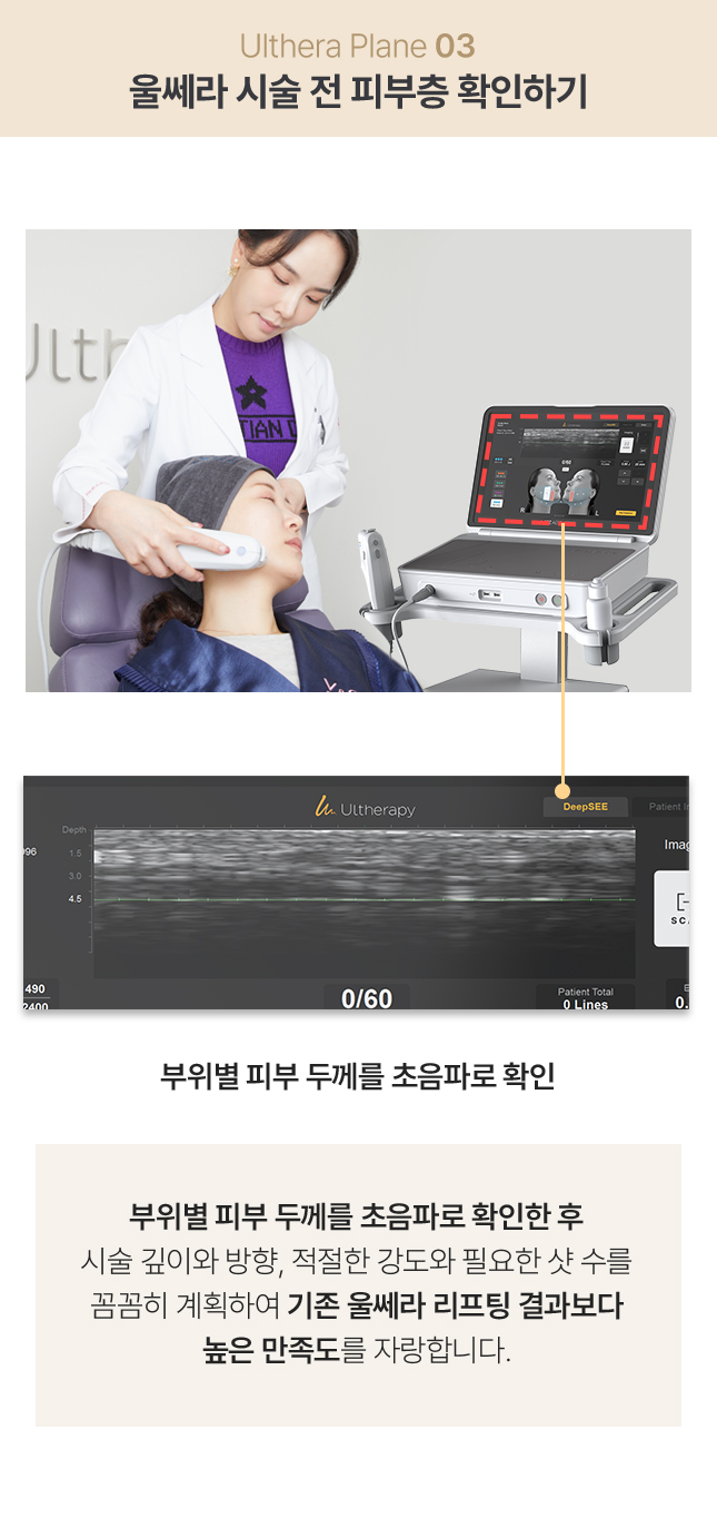 강남울쎄라,울쎄라피부과,울쎄라수면마취,울쎄라잘하는곳,압구정울쎄라,써마지울쎄라,울쎄라300샷,울써마지가격,아이써마지가격,아이써마지