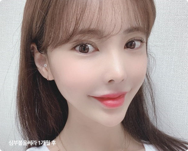 얼굴지방흡입가격,이중턱지방흡입비용,얼굴살빼는법,턱살지방흡입,심부볼수술,심부볼제거비용,턱살제거,턱리프팅,심부볼제거수술,턱처짐,판교리프팅,볼처짐리프팅,입가주름리프팅,이중턱리프팅,볼꺼짐,턱살리프팅,처진볼살리프팅,턱선리프팅