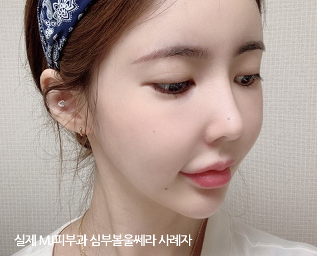 얼굴지방흡입가격,이중턱지방흡입비용,얼굴살빼는법,턱살지방흡입,심부볼수술,심부볼제거비용,턱살제거,턱리프팅,심부볼제거수술,턱처짐,판교리프팅,볼처짐리프팅,입가주름리프팅,이중턱리프팅,볼꺼짐,턱살리프팅,처진볼살리프팅,턱선리프팅