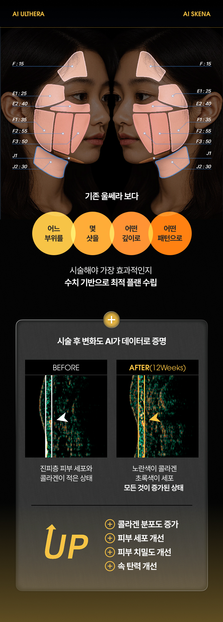 
				V&MJ 브이앤엠제이, 기존 울쎄라 보다 어느 부위를, 몇 샷을, 어떤 깊이로, 어떤 패턴으로 시술해야 가장 효과적인지 수치 기반으로 최적 플랜 수립
				콜라겐 분포도 증가, 피부 세포 개선, 피부 치밀도 개선, 속 탄력 개선
			