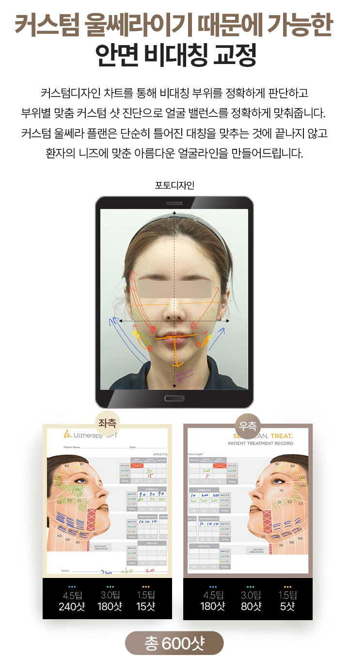 비대칭얼굴교정,안면비대칭교정병원,비대칭교정한의원,얼굴비대칭한의원,턱관절병원,안면비대칭교정방법,안면비대칭병원,안면비대칭치료,눈위치비대칭,얼굴교정