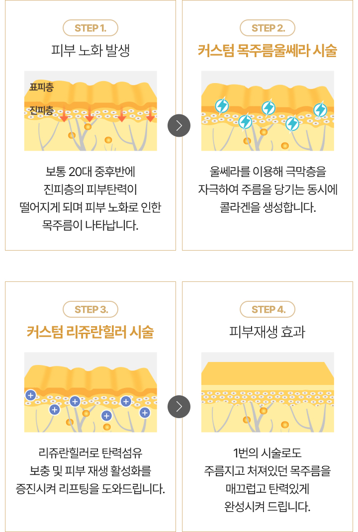 피부노화,목주름,울쎄라,콜라겐생성,극막층자극,리쥬란힐러,탄력섬유보충,피부재생촉진,피부재생효과
