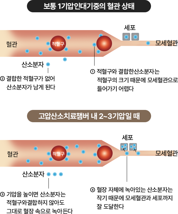 고농도산소,고압산소장치,고압산소테라피,산소캡슐가격,산소텐트,고압산소탱크,산소발생기