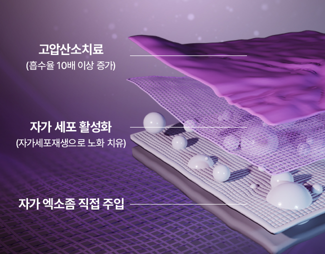IBEX,고압산소,산소챔버,고압옥시젠 파워 스템셀기가격,옥시젠 파워 스템셀기,고압산소캡슐,산소방