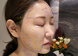 강남울쎄라,울쎄라피부과,울쎄라수면마취,울쎄라잘하는곳,압구정울쎄라,써마지울쎄라,울쎄라300샷,울써마지가격,아이써마지가격,아이써마지,올리지오가격