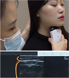포르테티타늄