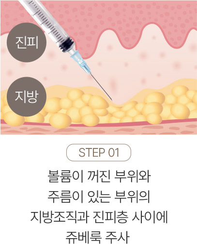 쥬베룩,쥬베룩가격,미라젯쥬베룩,쥬베룩효과,쥬베룩후기,스킨부스터,쥬베룩피부과,강남쥬베룩,포텐자,쥬베룩볼륨,피부과쥬베룩,리쥬란미라젯,쥬베룩미라젯,네오스템엑소좀