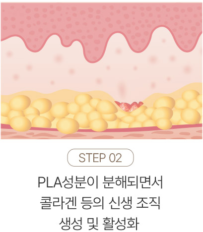 쥬베룩,쥬베룩가격,미라젯쥬베룩,쥬베룩효과,쥬베룩후기,스킨부스터,쥬베룩피부과,강남쥬베룩,포텐자,쥬베룩볼륨,피부과쥬베룩,리쥬란미라젯,쥬베룩미라젯,네오스템엑소좀