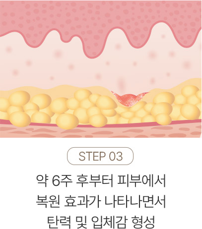 쥬베룩,쥬베룩가격,미라젯쥬베룩,쥬베룩효과,쥬베룩후기,스킨부스터,쥬베룩피부과,강남쥬베룩,포텐자,쥬베룩볼륨,피부과쥬베룩,리쥬란미라젯,쥬베룩미라젯,네오스템엑소좀