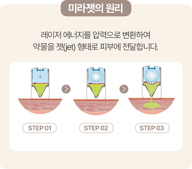 쥬베룩,쥬베룩가격,미라젯쥬베룩,쥬베룩효과,쥬베룩후기,스킨부스터,쥬베룩피부과,강남쥬베룩,포텐자,쥬베룩볼륨,피부과쥬베룩,리쥬란미라젯,쥬베룩미라젯,네오스템엑소좀