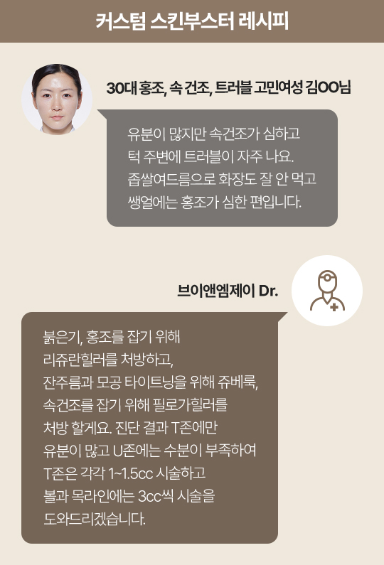 리쥬란힐러효과,스킨보톡스,리쥬메이트,리쥬란HB,쥬베룩,리쥬란HB플러스,리쥬란아이,리주란,리쥬란피부과
