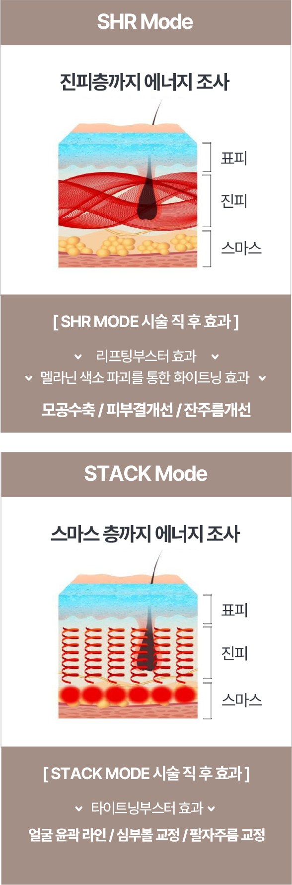 소프라노티타늄레이저,티타늄리프팅레이저,청담티타늄리프팅,청담티타늄,소프라노리프팅,듀얼티타늄,테스리프팅,테스실리프팅,볼뉴머,레몬주사,볼뉴머가격,대웅제약브이올렛,사이토케어