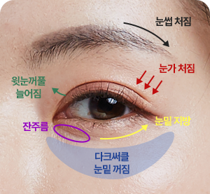 포르테티타늄