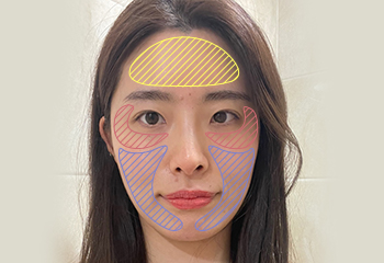 강남역울쎄라,인모드,울트라스킨,목주름울쎄라,써마지가격,써마지효과,써마지FLX,울쎄라시술,신사울쎄라,울쎄라200샷