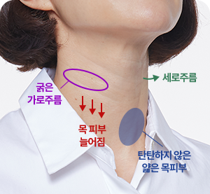 포르테티타늄