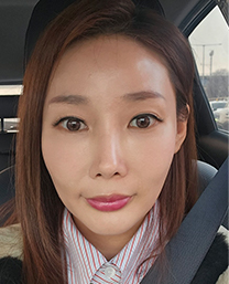 울쎄라전후,피부리프팅기기,얼굴리프팅,아이슈링크,슈링크리프팅,리프팅기구,홈케어슈링크,홈케어리프팅,인모드레이저,피부마사지기