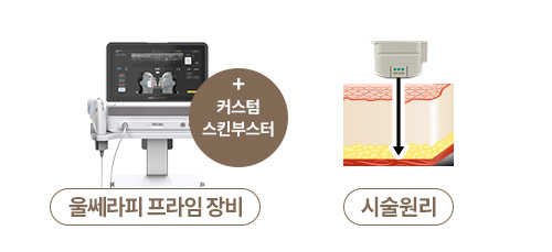 울쎄라멍,울쎄라 효과시기,울쎄라,슈링크효과,인모드효과,울쎄라후기,울쎄라리프팅,울써마지,써마지,아이울쎄라,커스텀울쎄라,커스텀써마지 