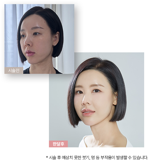 피부미용,남자화장품올인원,남성기능성화장품,50대남자화장품,남성기초화장품,남자파데,남성파운데이션,피부과여드름치료,남자화장품쇼핑몰,남자BB크림,남자울쎄라,울쎄라