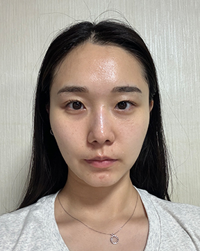 홈에스테틱,홈쎄라,압구정로데오피부과,가정용리프팅,갈바닉마사지기,강남튠페이스,홈케어디바이스,가정용미용기기,리프팅기기,슈링크유니버스