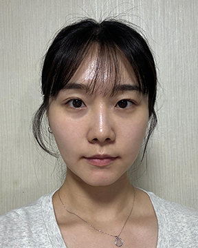 홈에스테틱,홈쎄라,압구정로데오피부과,가정용리프팅,갈바닉마사지기,강남튠페이스,홈케어디바이스,가정용미용기기,리프팅기기,슈링크유니버스