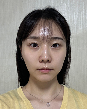 홈에스테틱,홈쎄라,압구정로데오피부과,가정용리프팅,갈바닉마사지기,강남튠페이스,홈케어디바이스,가정용미용기기,리프팅기기,슈링크유니버스