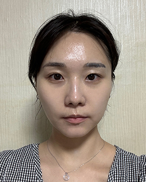 홈에스테틱,홈쎄라,압구정로데오피부과,가정용리프팅,갈바닉마사지기,강남튠페이스,홈케어디바이스,가정용미용기기,리프팅기기,슈링크유니버스