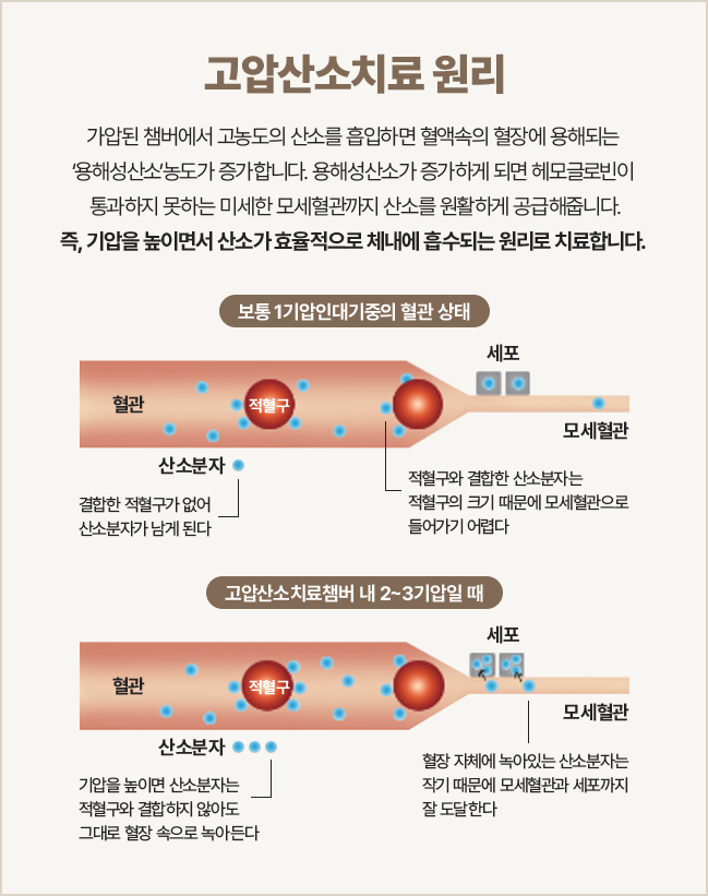 웰로리프텐,듀얼소닉,튠페이스효과,피부관리기,홈뷰티디바이스,가정용피부관리기,얼굴리프팅기구,슈링크300샷,울쎄라기기,리프팅기계,인모드FX