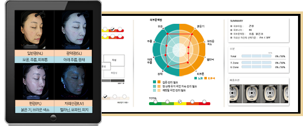 마크뷰,피부타입,피부진단기,피부측정기,피부분석기,피부진단기기,피부수분측정기,MARKVU,JANUS,PSIPLUS,MARK-VU,유수분측정기,피부검사,피부연구소,피부상담