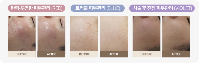 마크뷰,피부타입,피부진단기,피부측정기,피부분석기,피부진단기기,피부수분측정기,MARKVU,JANUS,PSIPLUS,MARK-VU,유수분측정기,피부검사,피부연구소,피부상담